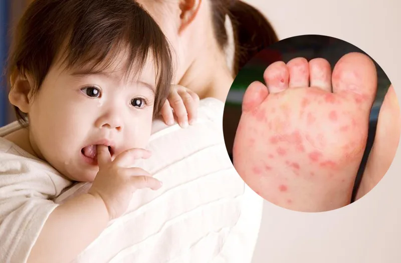 Sử dụng chung đồ chơi chưa được khử khuẩn là một trong những con đường lây truyền virus phổ biến.